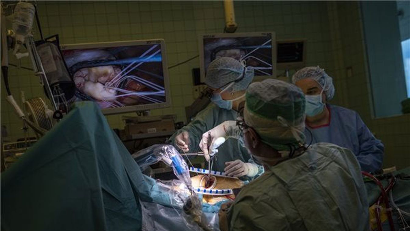 Rendhagyó szívbillentyűműtétet végeztek el Szegeden