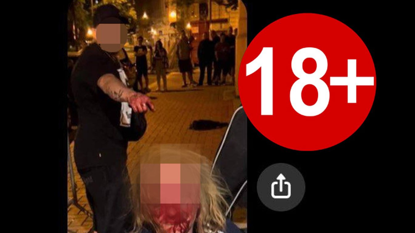 BRUTÁLIS: Szeged belvárosában vertek össze egy férfit!
