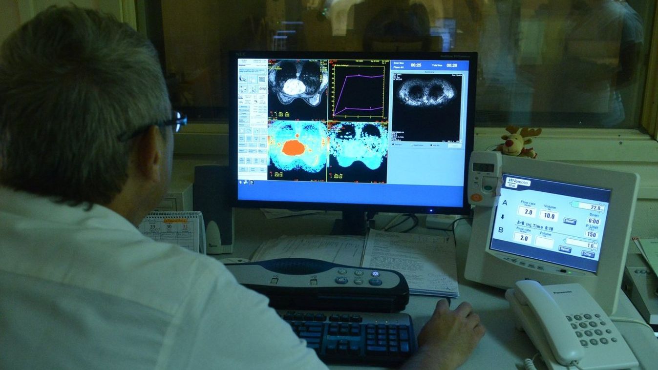 Kormányzati milliárdokból újul meg a radiológiai ellátás Szegeden
