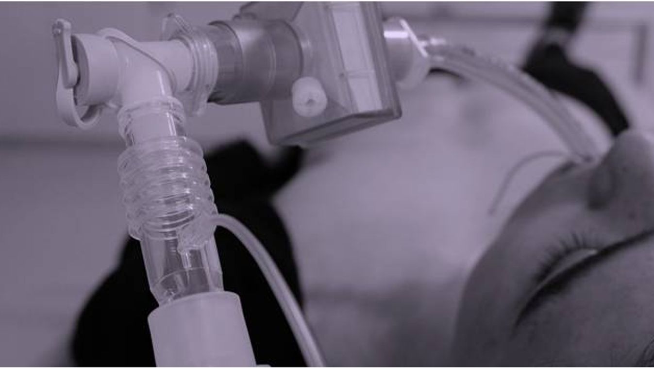 Szegedi közreműködéssel fejlesztik a tömeg-lélegeztetőgépet