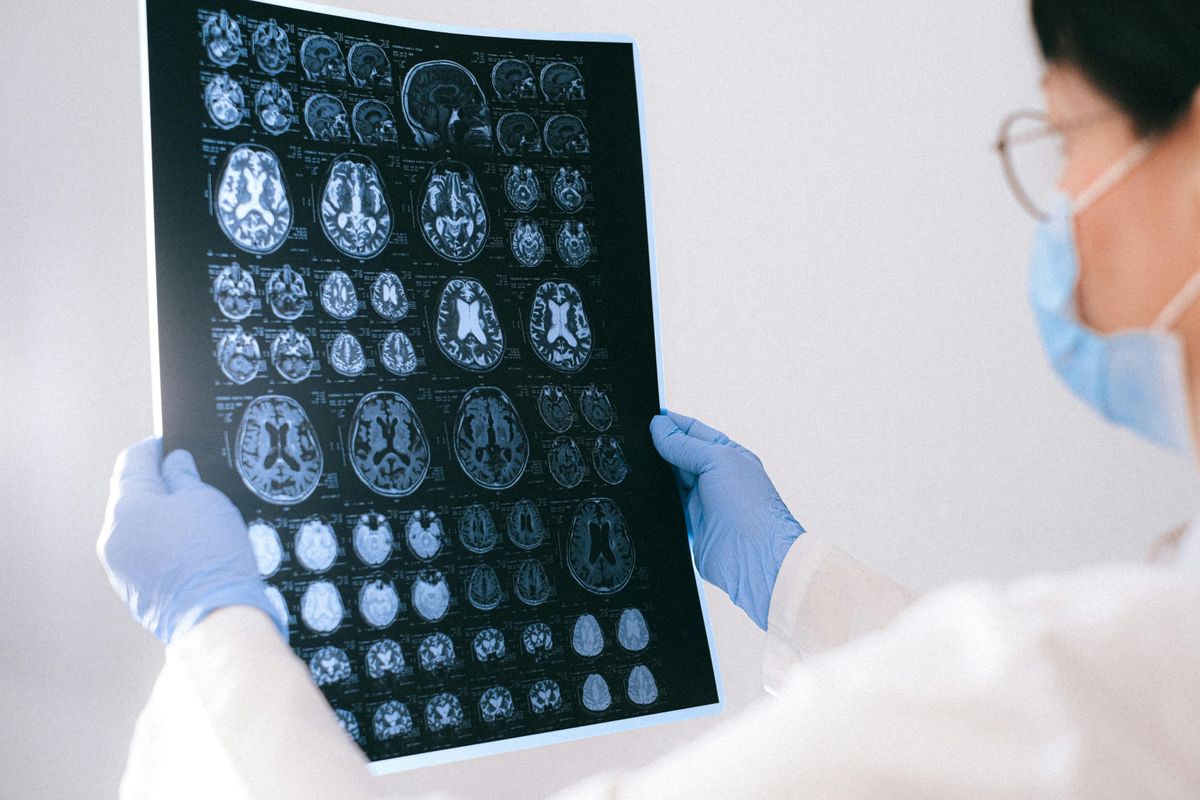 A projekt keretében az Alzheimer-kór eddig ismeretlen okait kutatják Fotó: Illusztráció/Pexels