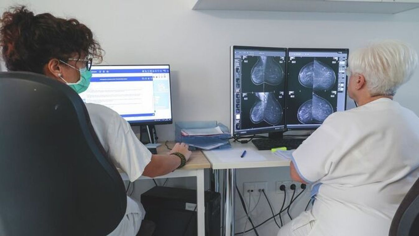 Életet menthet: hosszabbított mellrákszűrés Szegeden