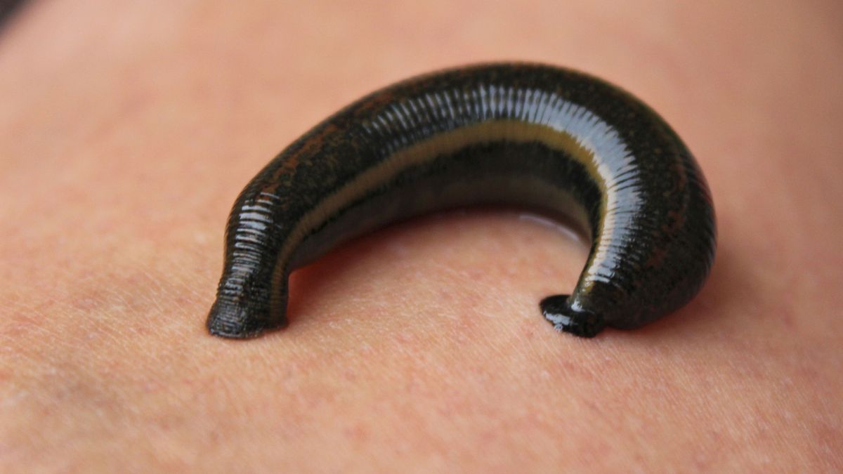 A modern orvosi pióca terápia reneszánszát éli Szegeden. (Fotó: pxhere.com)